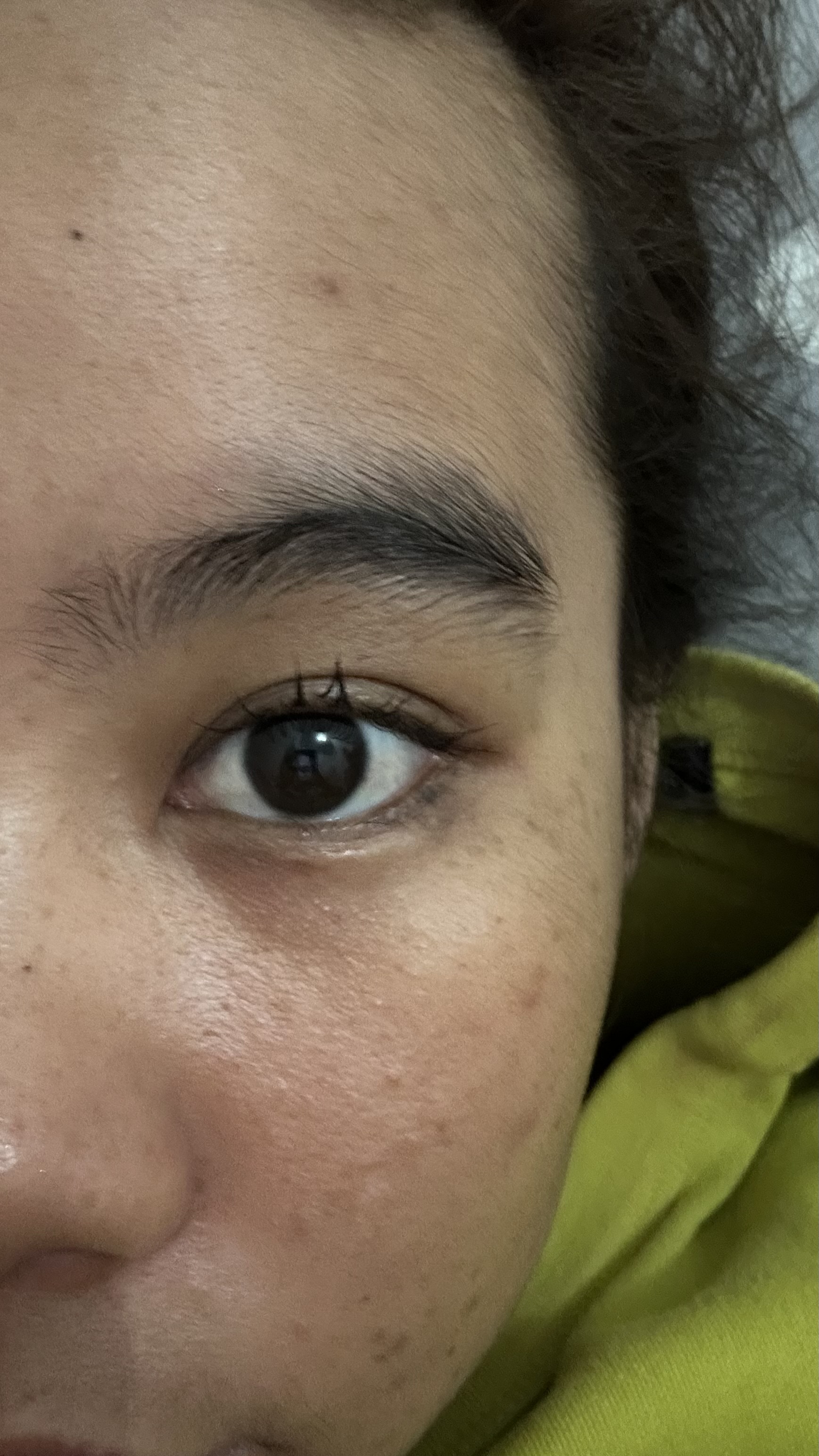 Eye Image